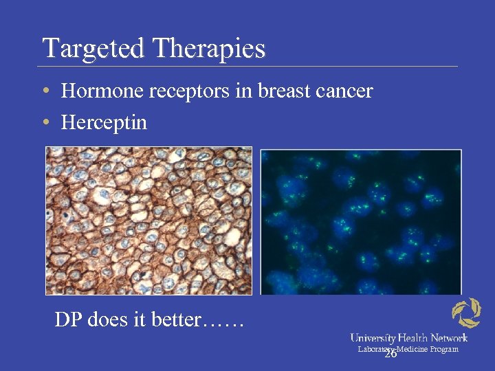 Targeted Therapies • Hormone receptors in breast cancer • Herceptin DP does it better……