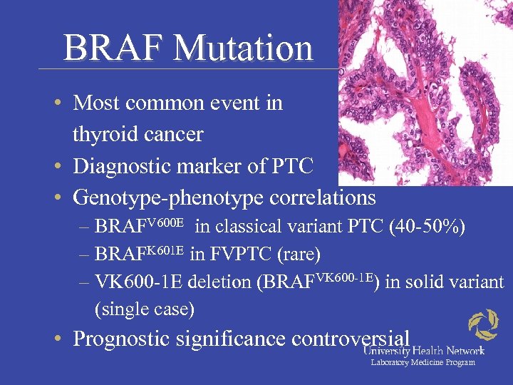 BRAF Mutation • Most common event in thyroid cancer • Diagnostic marker of PTC