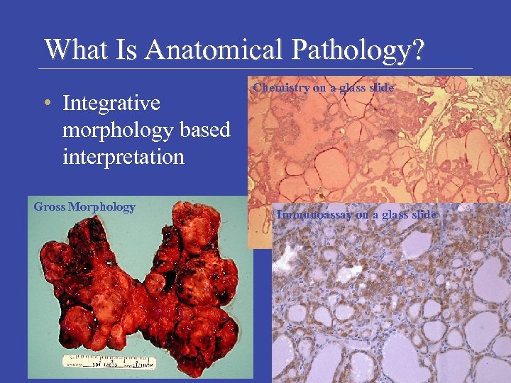 What Is Anatomical Pathology? • Integrative morphology based interpretation Gross Morphology Chemistry on a