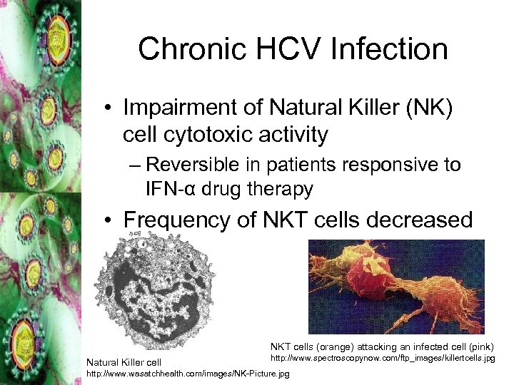 Chronic HCV Infection • Impairment of Natural Killer (NK) cell cytotoxic activity – Reversible