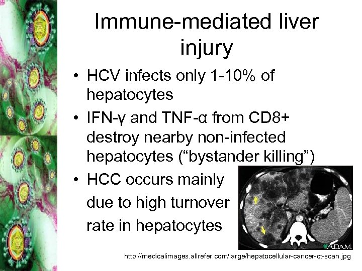 Immune-mediated liver injury • HCV infects only 1 -10% of hepatocytes • IFN-γ and