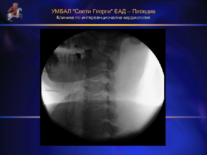 УМБАЛ "Свети Георги" ЕАД – Пловдив Клиника по интервенционална кардиология 