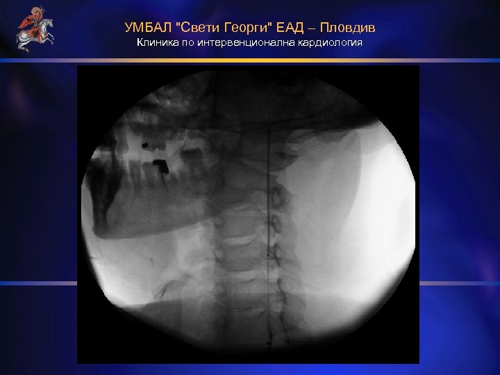 УМБАЛ "Свети Георги" ЕАД – Пловдив Клиника по интервенционална кардиология 