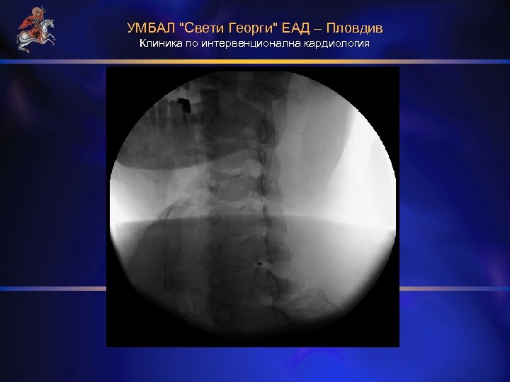 УМБАЛ "Свети Георги" ЕАД – Пловдив Клиника по интервенционална кардиология 