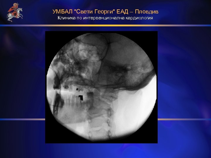 УМБАЛ "Свети Георги" ЕАД – Пловдив Клиника по интервенционална кардиология 