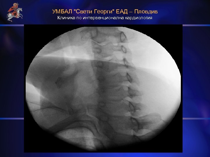 УМБАЛ "Свети Георги" ЕАД – Пловдив Клиника по интервенционална кардиология 