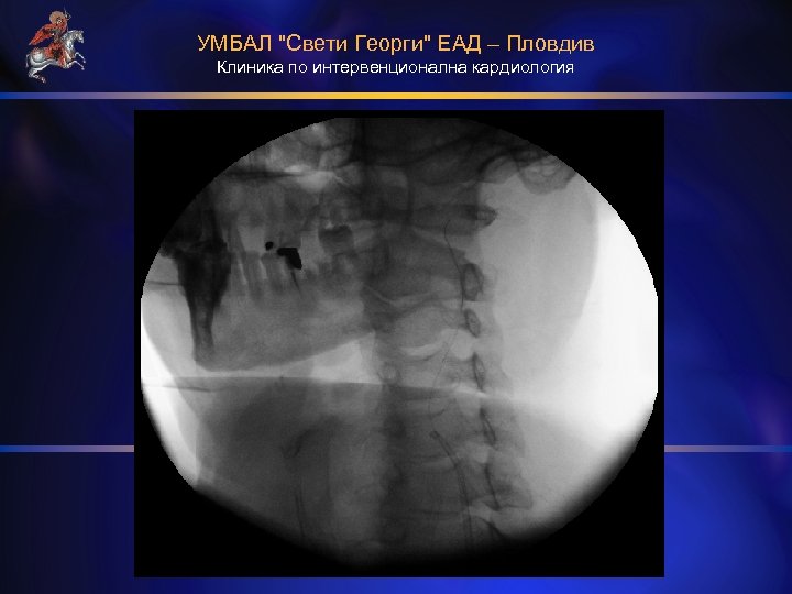 УМБАЛ "Свети Георги" ЕАД – Пловдив Клиника по интервенционална кардиология 