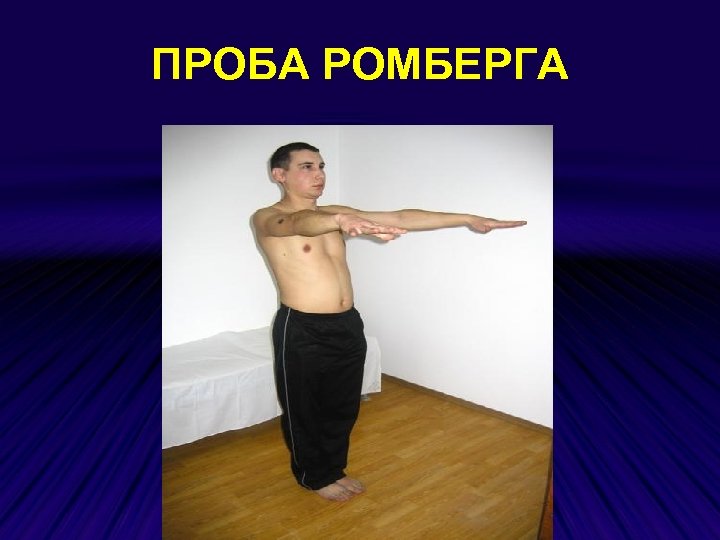 ПРОБА РОМБЕРГА 