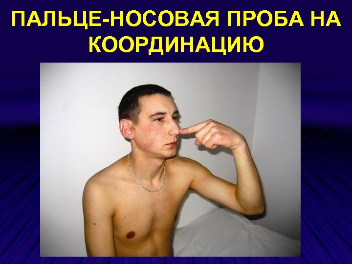 ПАЛЬЦЕ-НОСОВАЯ ПРОБА НА КООРДИНАЦИЮ 