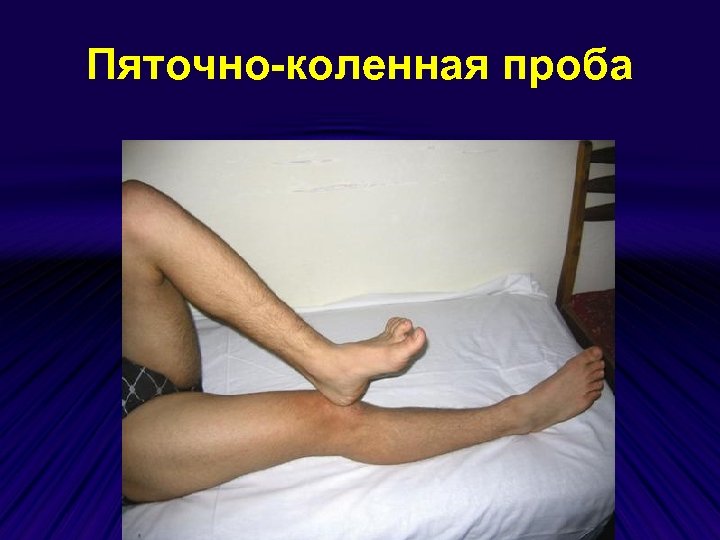 Пяточно-коленная проба 