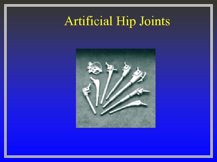 Artificial Hip Joints 