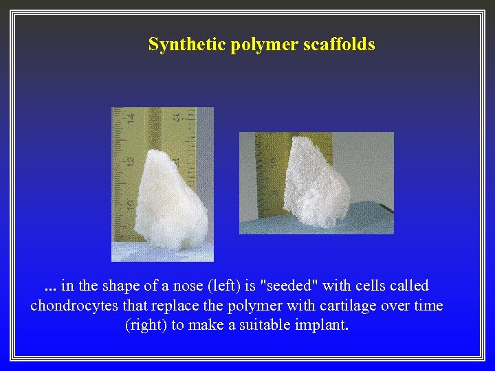 Synthetic polymer scaffolds . . . in the shape of a nose (left) is
