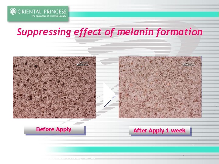 Suppressing effect of melanin formation Before Apply * Tested in women by Seki Dermatology