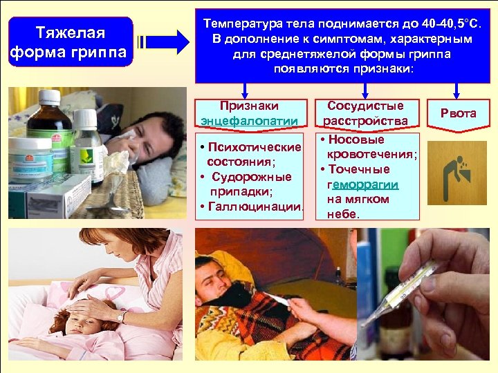 Тяжелая форма гриппа Температура тела поднимается до 40 40, 5°С. В дополнение к симптомам,