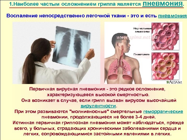 1. Наиболее частым осложнением гриппа является пневмония. Воспаление непосредственно легочной ткани это и есть