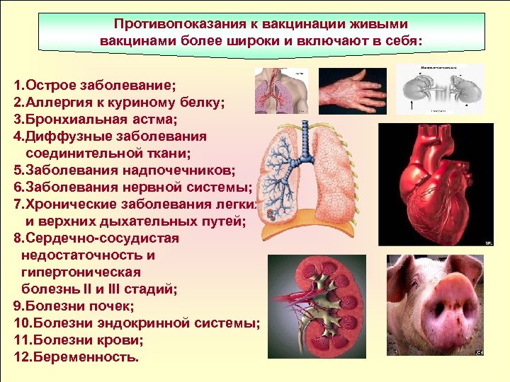 Противопоказания к вакцинации живыми вакцинами более широки и включают в себя: 1. Острое заболевание;