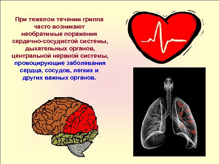 При тяжелом течении гриппа часто возникают необратимые поражения сердечно сосудистой системы, дыхательных органов, центральной
