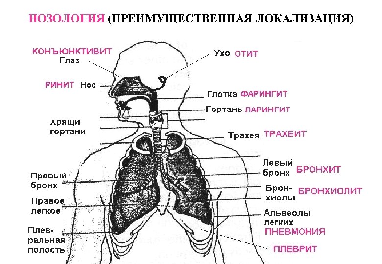 НОЗОЛОГИЯ (ПРЕИМУЩЕСТВЕННАЯ ЛОКАЛИЗАЦИЯ) 