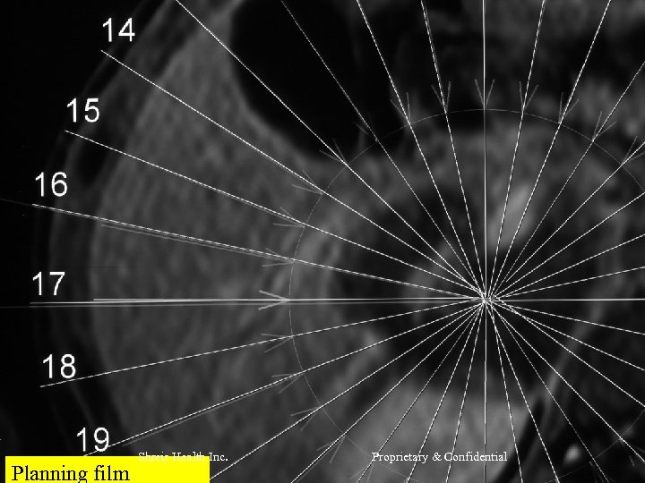 Planning film Shreis Health Inc. Proprietary & Confidential 