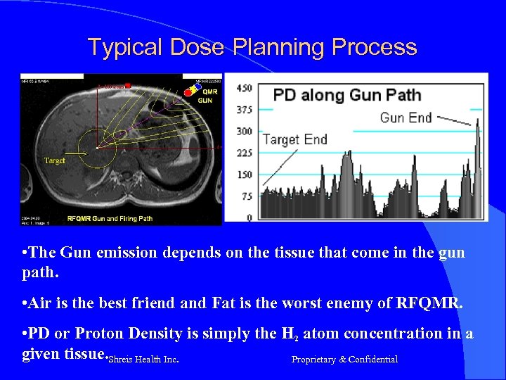 Typical Dose Planning Process • The Gun emission depends on the tissue that come