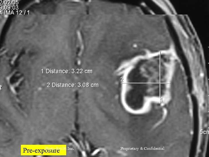 Shreis Health Pre-exposure Inc. Proprietary & Confidential 
