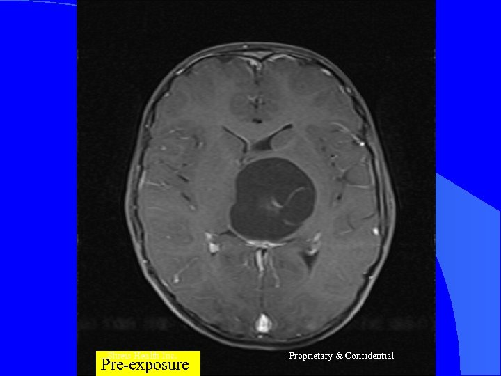 Shreis Health Inc. Pre-exposure Proprietary & Confidential 