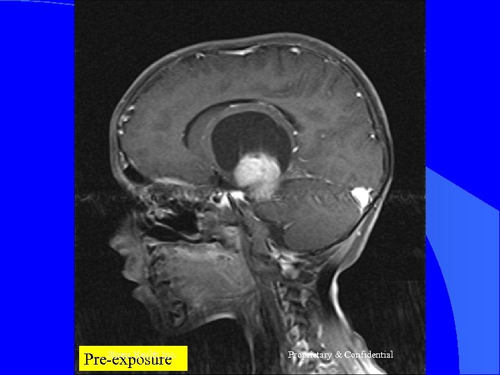 Shreis Health Inc. Pre-exposure Proprietary & Confidential 