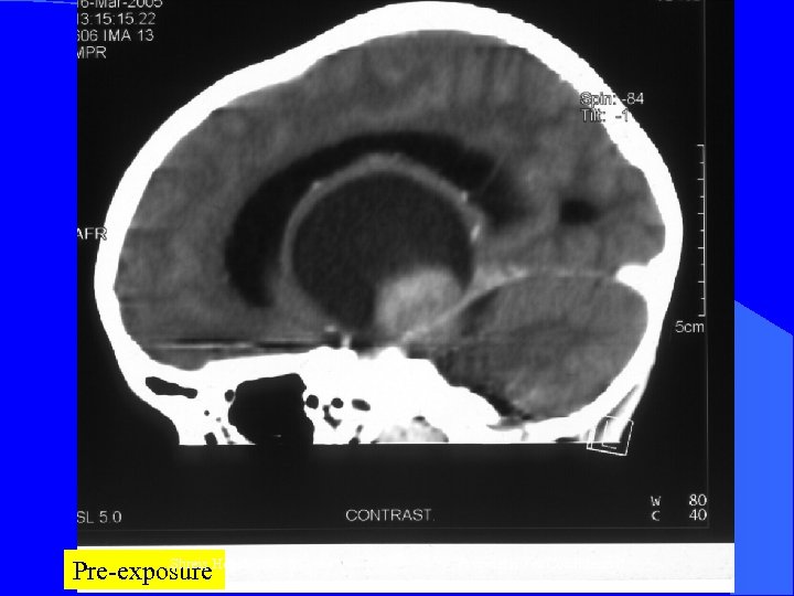 Shreis Pre-exposure. Health Inc. Proprietary & Confidential 