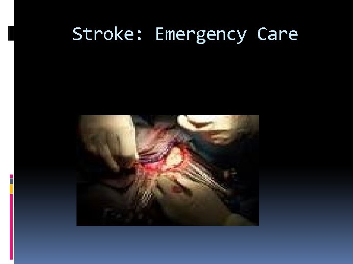 Stroke: Emergency Care 