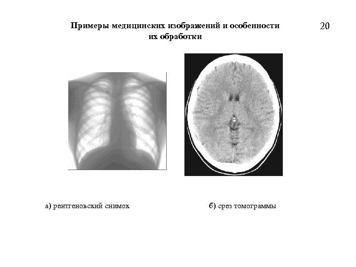 Примеры медицинских изображений и особенности их обработки а) рентгеновский снимок б) срез томограммы 20