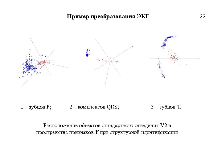 Пример преобразования ЭКГ 1 – зубцов P; 2 – комплексов QRS; 3 – зубцов