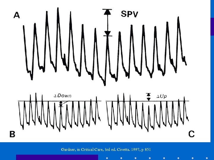 Gardner, in Critical Care, 3 rd ed. Civetta. 1997, p 851 