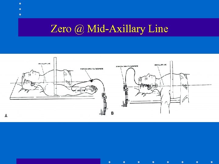 Zero @ Mid-Axillary Line 