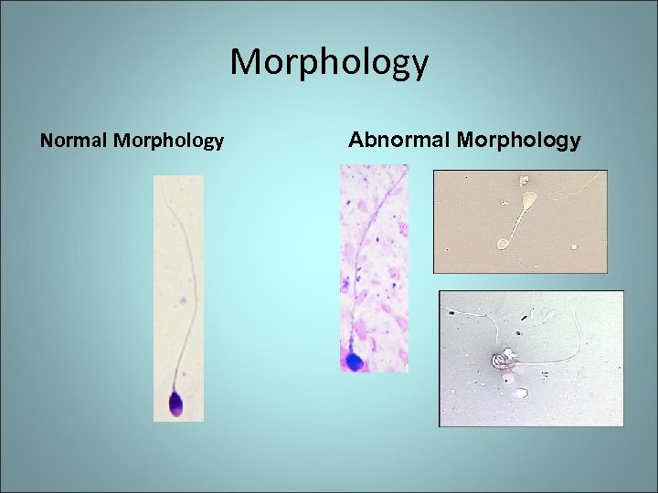 Morphology Normal Morphology Abnormal Morphology 