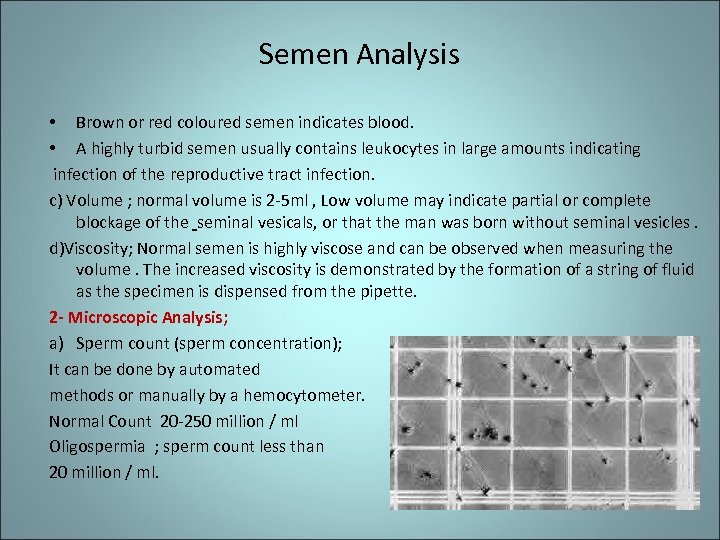 Semen Analysis • Brown or red coloured semen indicates blood. • A highly turbid