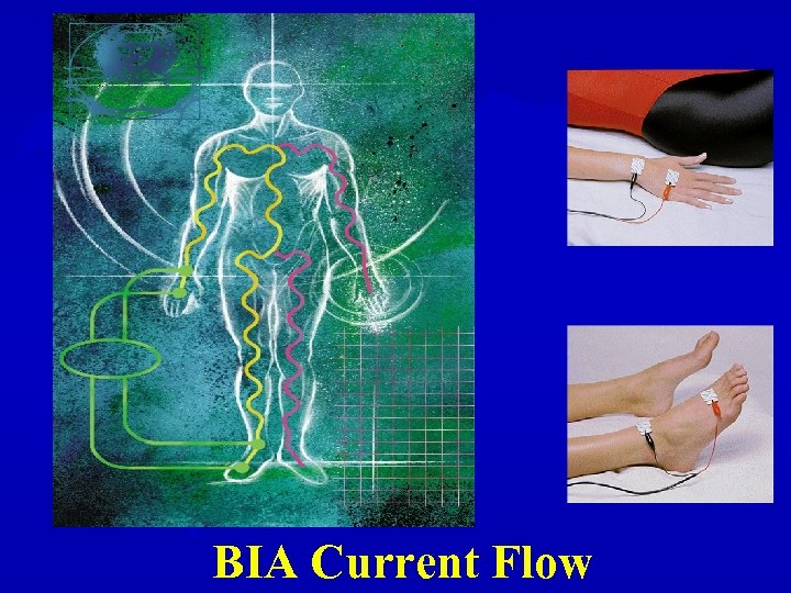 BIA Current Flow 