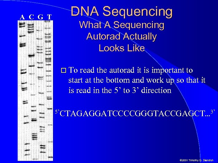 A C G T DNA Sequencing What A Sequencing Autorad Actually Looks Like To