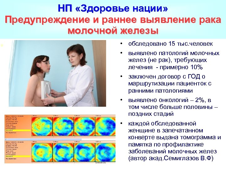 НП «Здоровье нации» Предупреждение и раннее выявление рака молочной железы • обследовано 15 тыс.