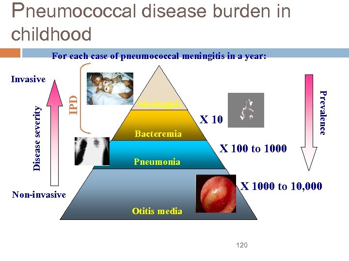 Pneumococcal disease burden in childhood For each case of pneumococcal meningitis in a year: