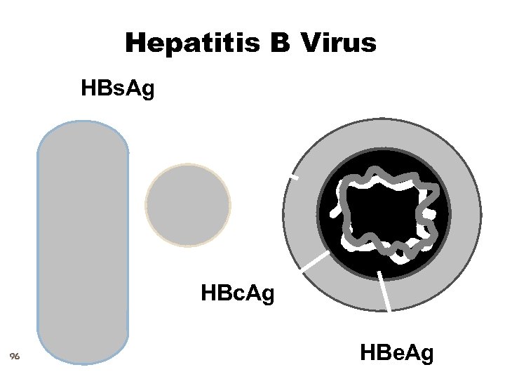 Hepatitis B Virus HBs. Ag HBc. Ag 96 HBe. Ag 