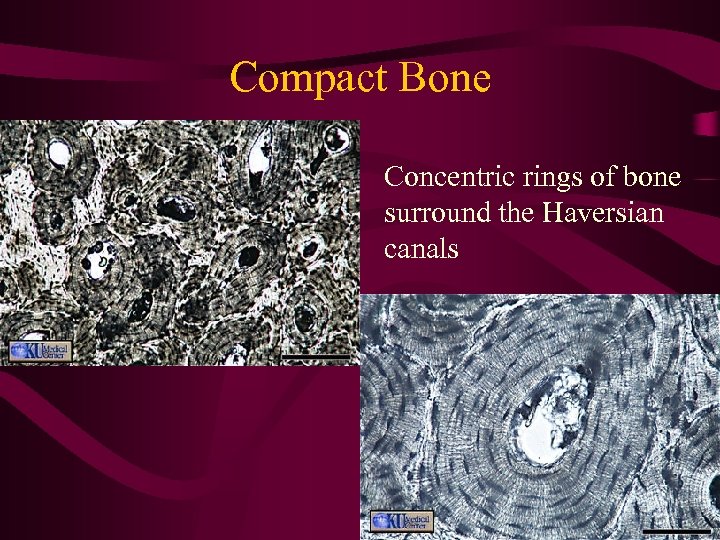 Compact Bone Concentric rings of bone surround the Haversian canals 