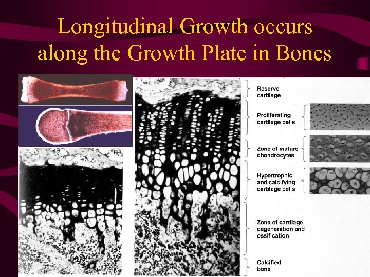 Longitudinal Growth occurs along the Growth Plate in Bones 