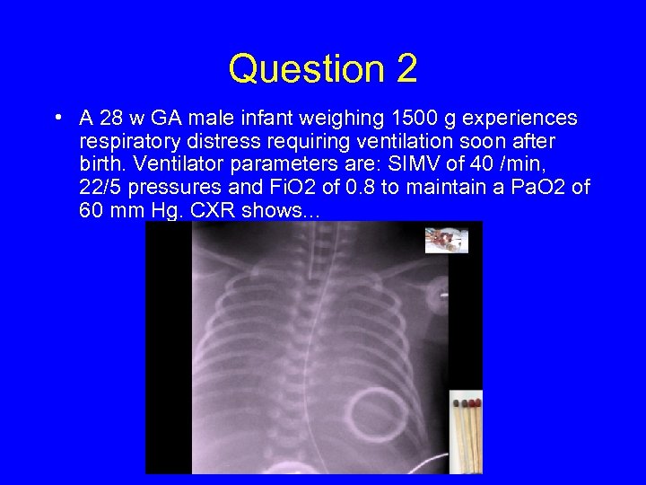 Question 2 • A 28 w GA male infant weighing 1500 g experiences respiratory