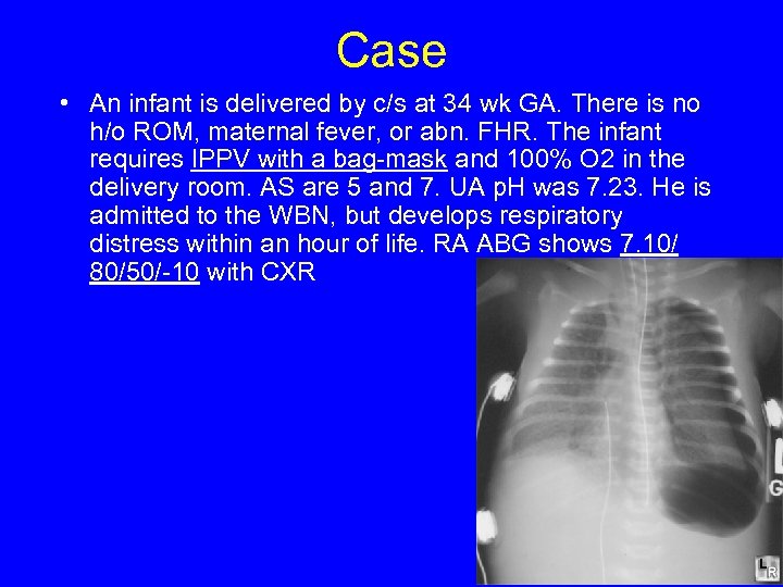 Case • An infant is delivered by c/s at 34 wk GA. There is