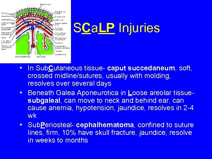 SCa. LP Injuries • In Sub. Cutaneous tissue- caput succedaneum, soft, crossed midline/sutures, usually