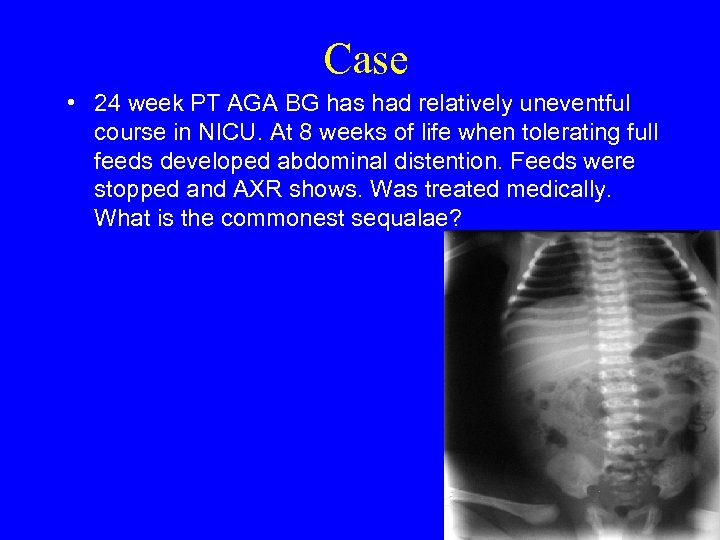 Case • 24 week PT AGA BG has had relatively uneventful course in NICU.