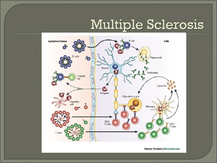 Multiple Sclerosis 