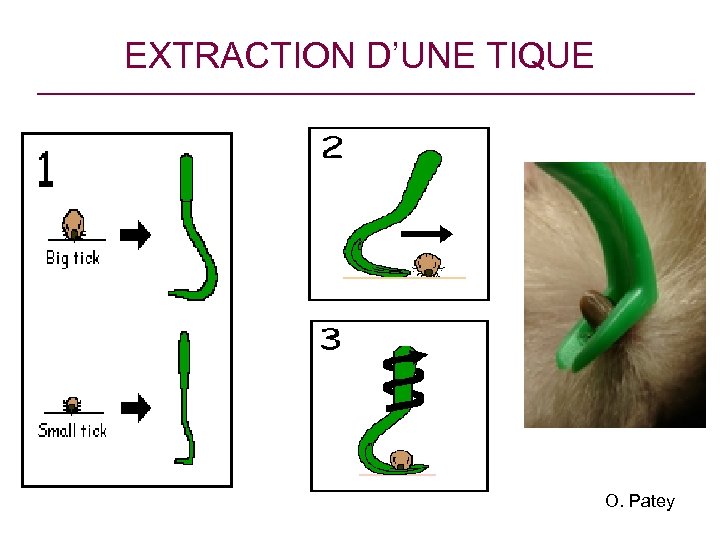 EXTRACTION D’UNE TIQUE O. Patey 