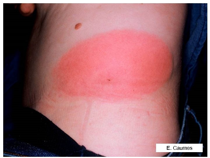 E. Caumes 