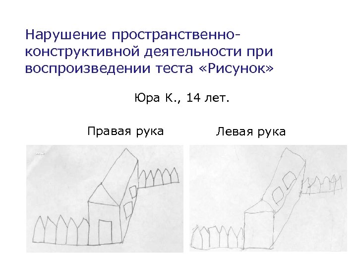 Нарушение пространственноконструктивной деятельности при воспроизведении теста «Рисунок» Юра К. , 14 лет. Правая рука